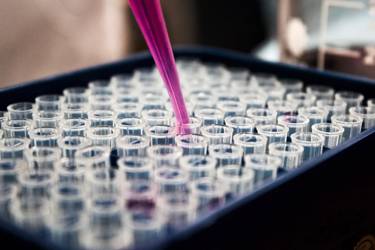Tubos de ensayo en una gradilla de laboratorio, referencia de exámenes de sangre